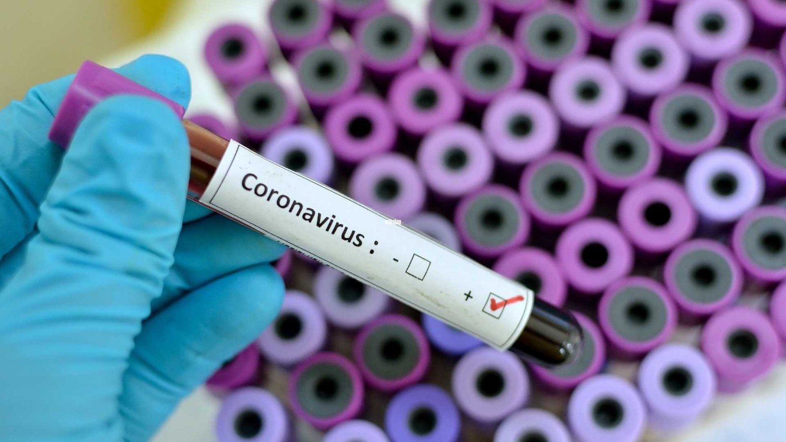 koronavirus miatt